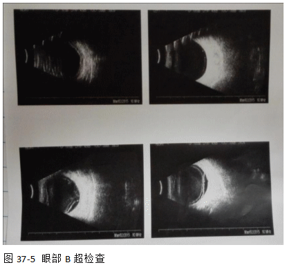 ZY016_195_1.gif